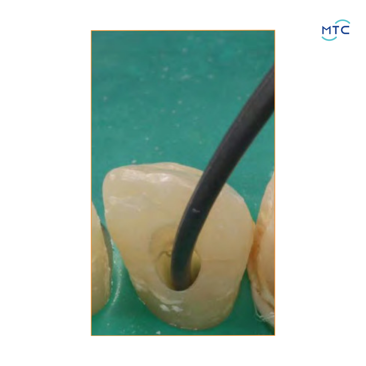 Bio C Temp بايو سيراميك انترا كنل مدكيشن