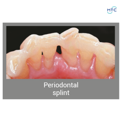 Angelus Interlig Restorative Materials