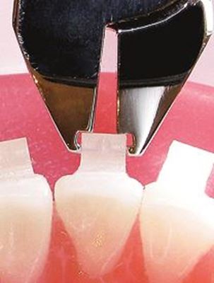 IOS Ceramic Bracket Debonding plier Orthodontic Plier