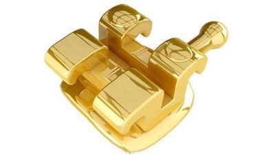 IOS Gold Brackets Kit 5 To 5 .022 w/ hooks 3s 4s&5 - Kit Orthodontic Brackets