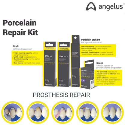 Angelus Porcelain Repair Kit Restorative Materials