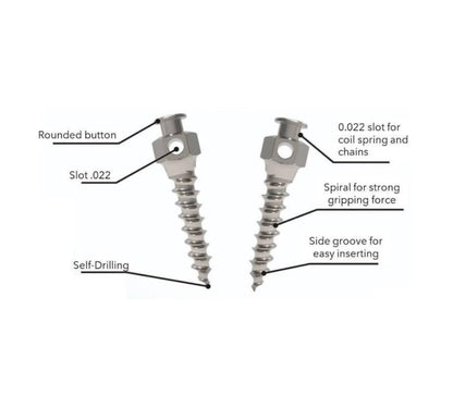 Medico Hi Fix Mini screw - TADS Orthodontic Mini-Implant (TAD)