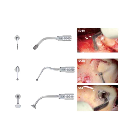 Ultrasonic Bone Surgery System Ultrasonic Scaler